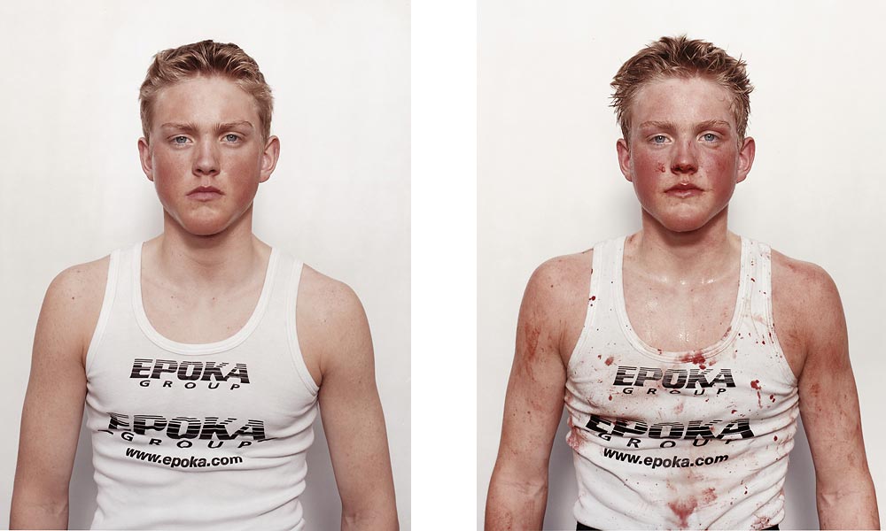 Boxing Before And After Images