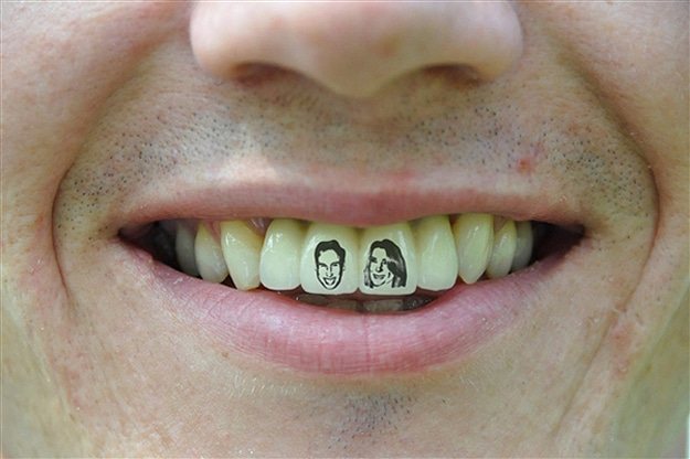 William and Kate Tooth Tattoo