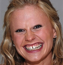 Celebrities Without Eyebrows: A Fun Photoshop Collection