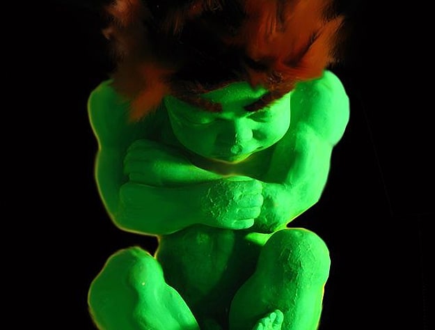 Incredible Hulk In The Womb