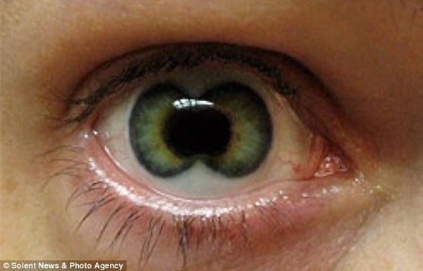 Double Iris Eye Contacts