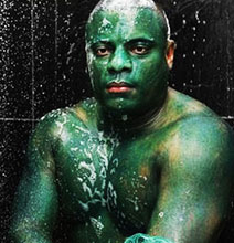 The Man Who Got Green Hulk Skin (Kids, Don’t Try This At Home)
