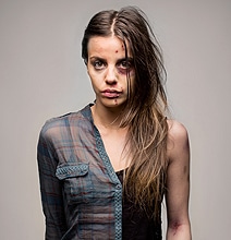 How Drug Abuse Affects The Body: Before & After Photography