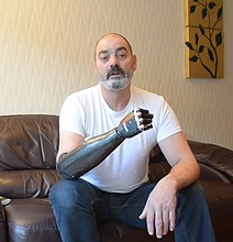 Prosthetic Arm Just Made Luke Skywalker Technology A Reality