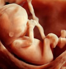 3D Ultrasound Imaging Creates 3D Color Photo Of Your Unborn Baby 3D Ultrasound Imaging Creates 3D Color Photo Of Your Unborn Baby