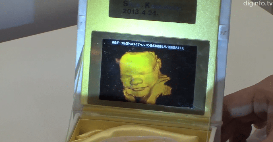 3d-ultrasaound-hologram-pictures