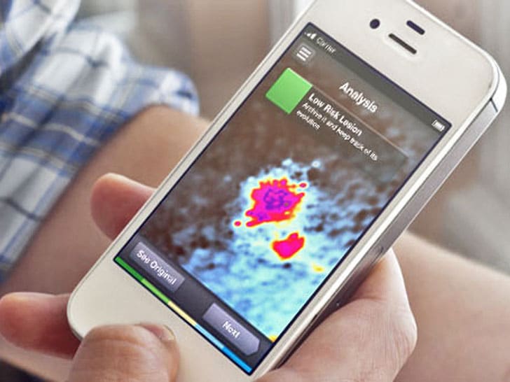 skinvision-app-skin-cancer-scanner