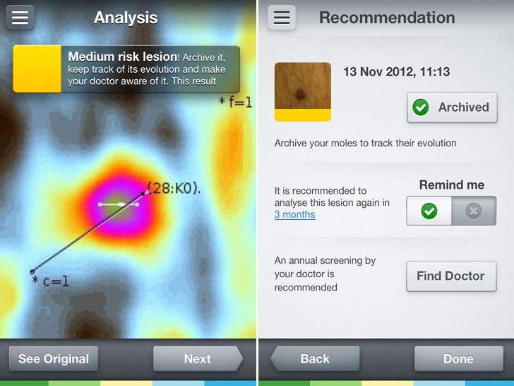 skinvision-app-skin-cancer-scanner