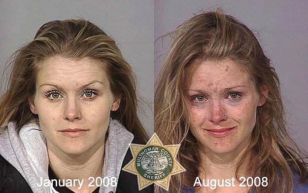 The Effects of Drug Abuse Mug Shots of Drug Addicts