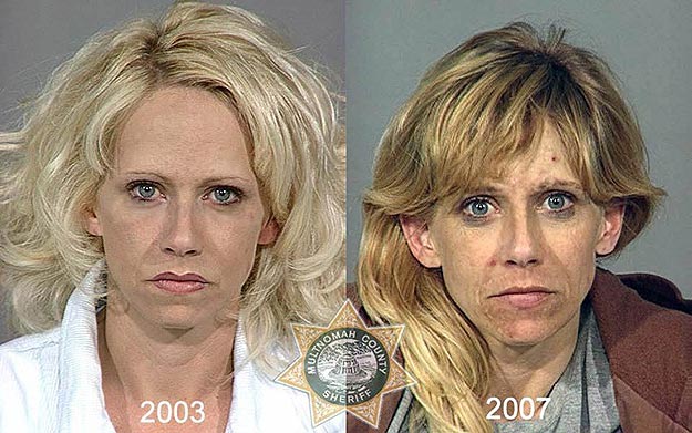 The Effects of Drug Abuse Mug Shots of Drug Addicts