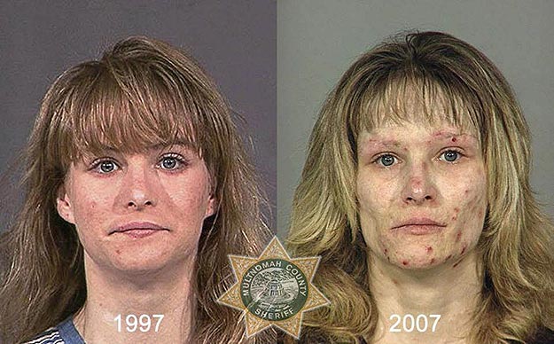 Effects of Meth Heroin Cocaine Mug Shots of Drug Addicts