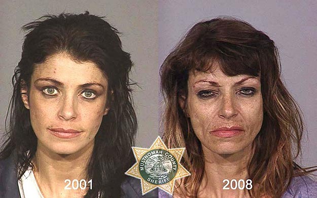 Facial Effects of Drug Abuse Mug Shots of Drug Addicts