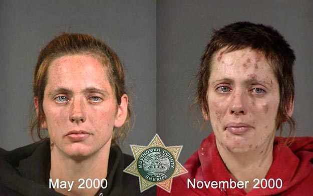 Drug Addicts and Drug Addiction Mug Shots of Drug Addicts