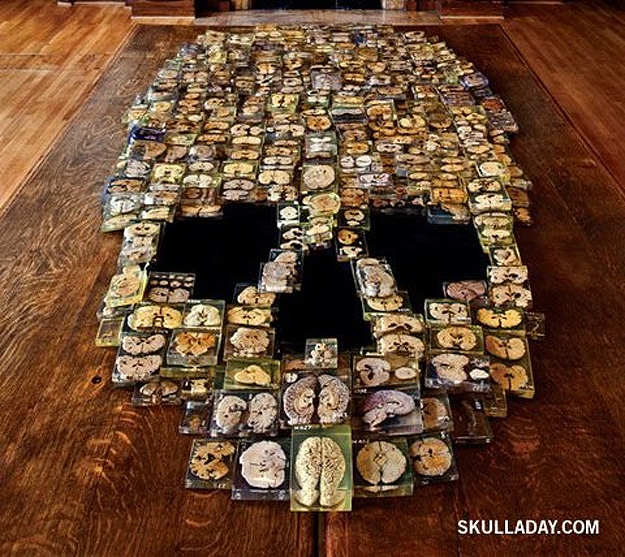 Skull Created From Brain Slices