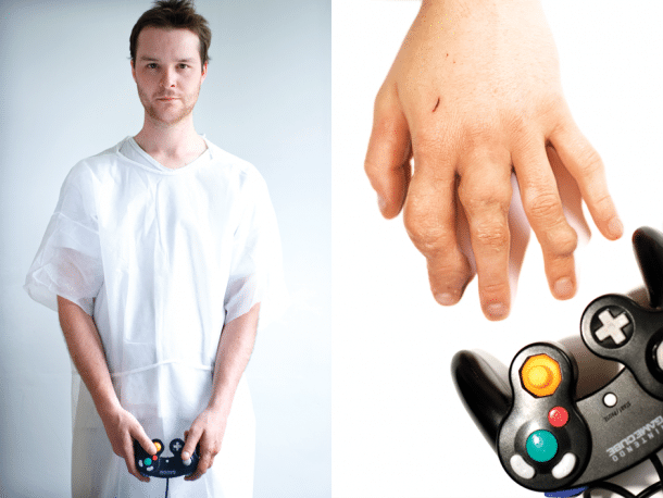 Arcade Gaming Injuries And Diseases