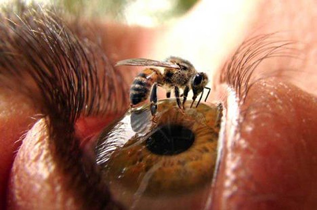 Bee Sting On Brown Eyeball Close Up Eye Image