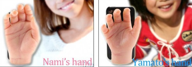 Severed Hand Smartphone Cover