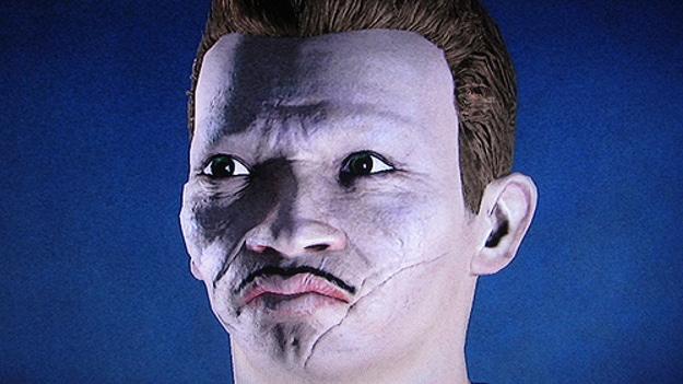 Resemblance to a bulldog