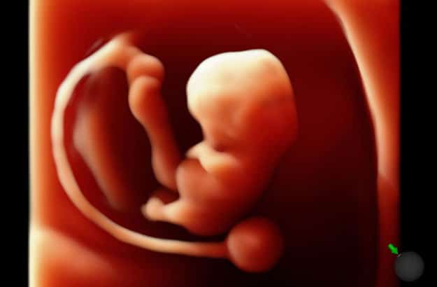 3d-ultrasound-color-baby-photos