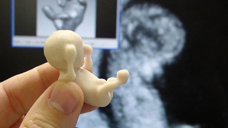 unborn-baby-3d-sonogram