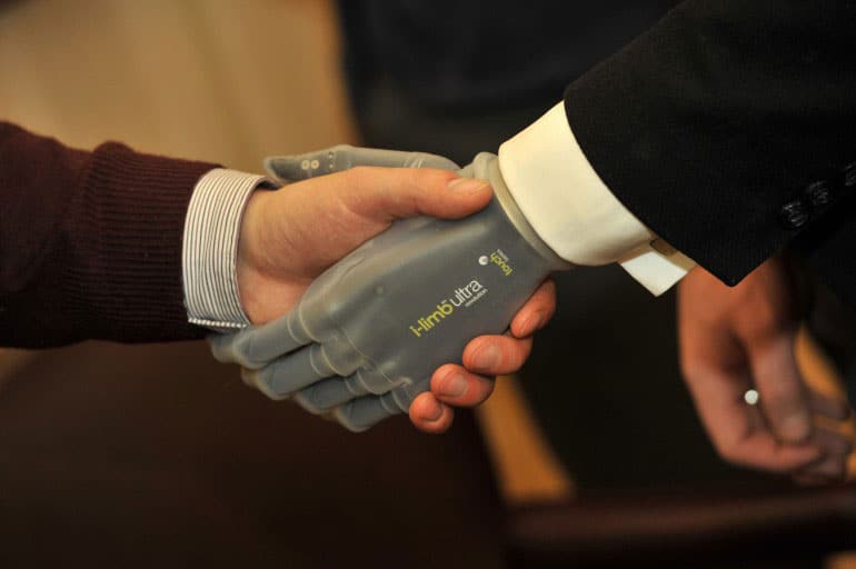 app-controlled-prosthetic-hand-technology