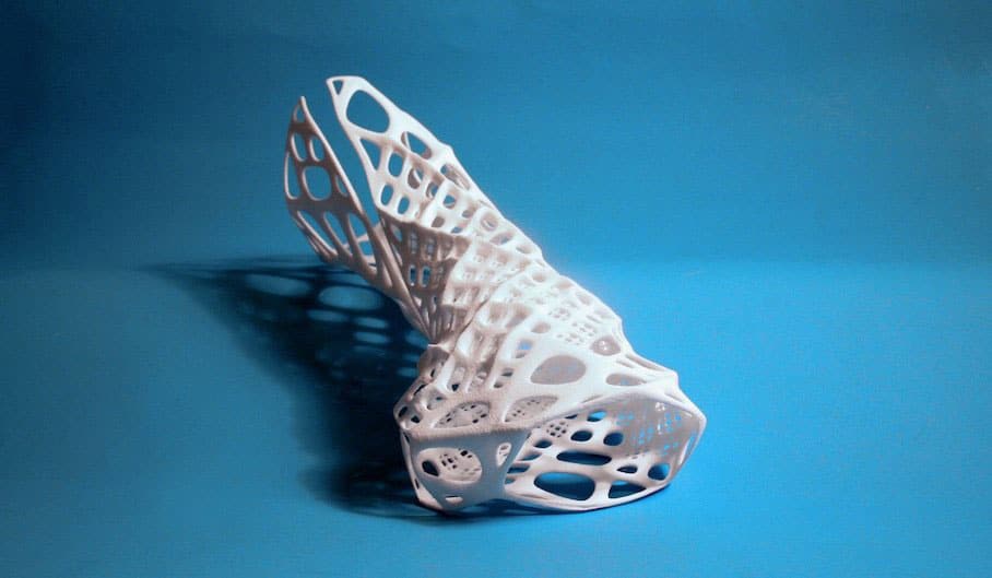 3d-printed-wrist-splint 3d-printed-wrist-splint