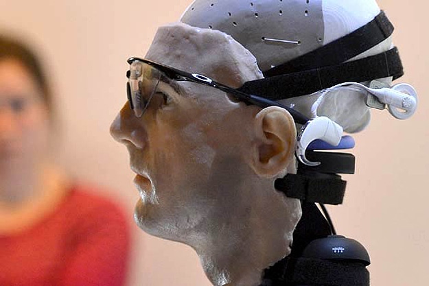 Worlds First Bionic Man Worlds First Bionic Man